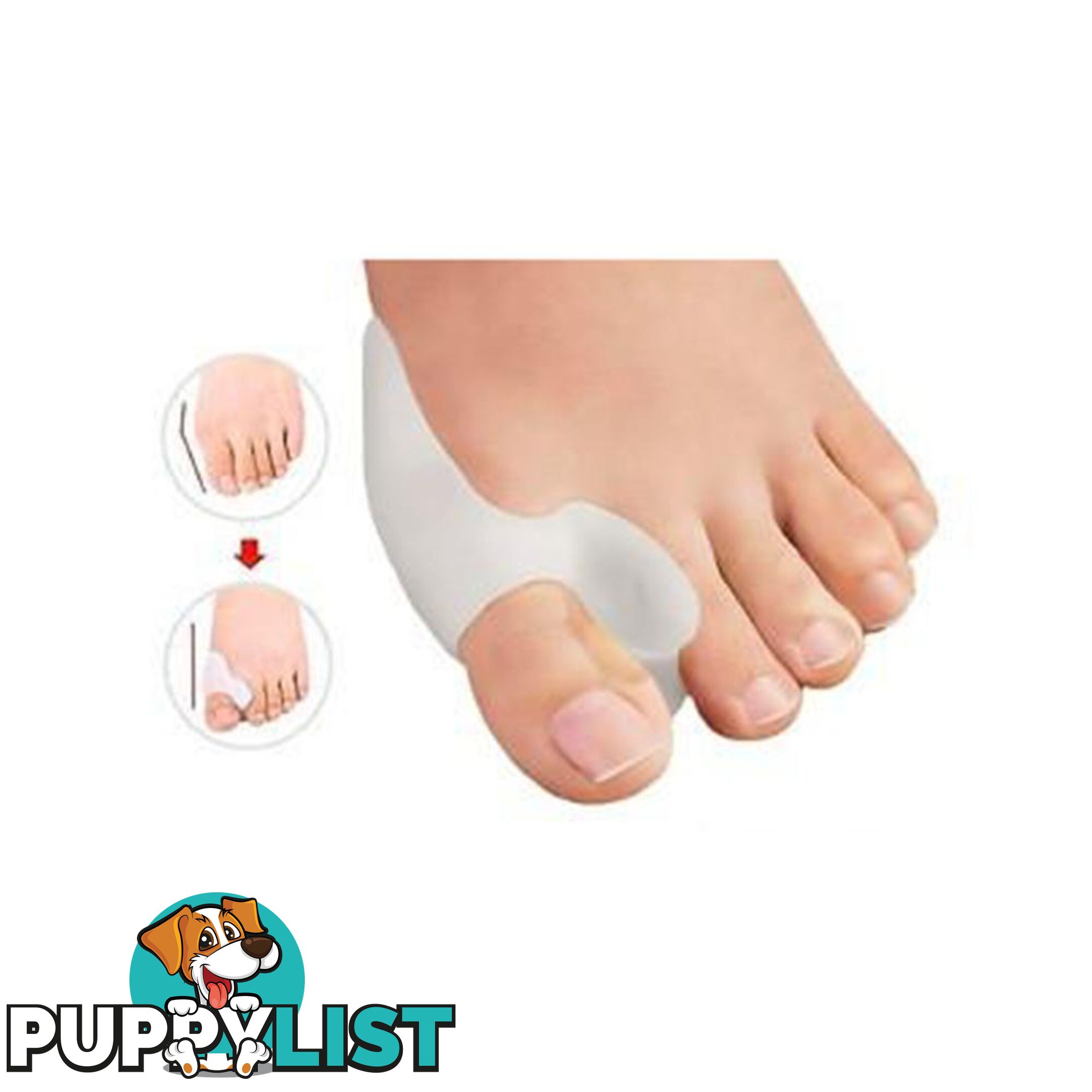 Silicone Toe Alignment Support - Unbranded - 7427005873478