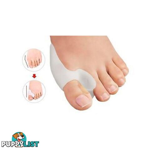 Silicone Toe Alignment Support - Unbranded - 7427005873478