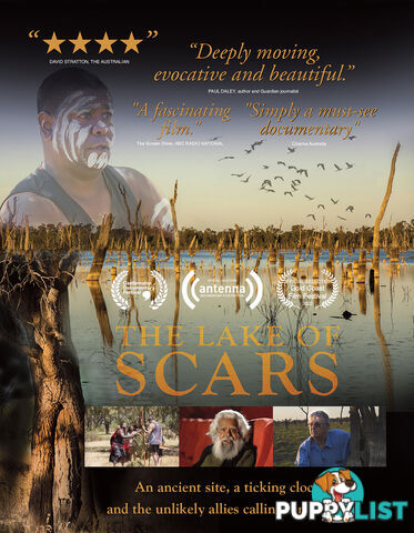 Lake of Scars, The (Lifetime Access)